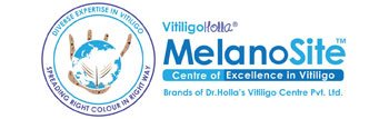 vitiligo treatment bangalore